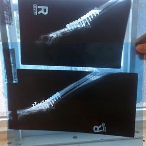 Leg in splint